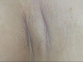 300人の腋 2　サンプル画像10